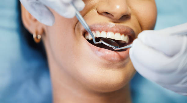 Best Walk-In Emergency Dentist in Camdenton, MO
